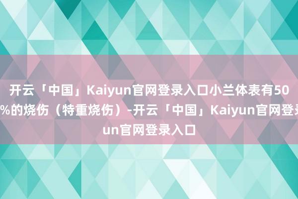 开云「中国」Kaiyun官网登录入口小兰体表有50%-59%的烧伤（特重烧伤）-开云「中国」Kaiyun官网登录入口